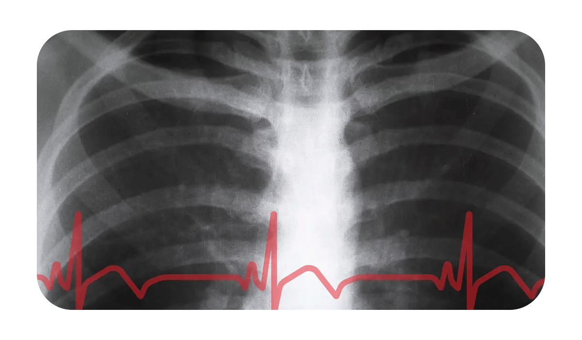 Website Image - EKGaction Page - Tab Content Module - Chest X Rays
