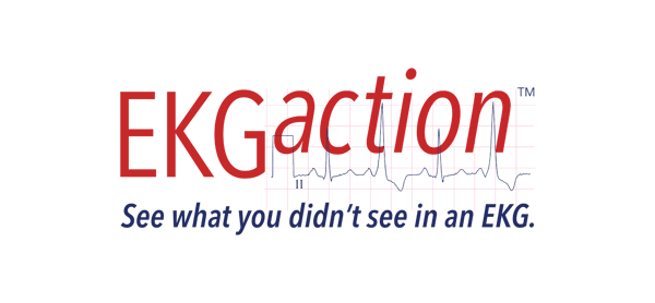 EKGaction Logo