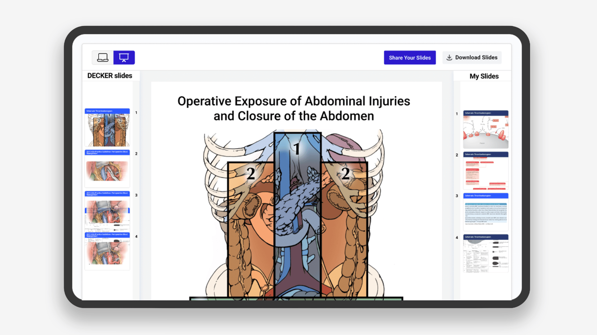 Website Image - Decker Page - Tab Content Module  - Product Image - Teaching Slides Library
