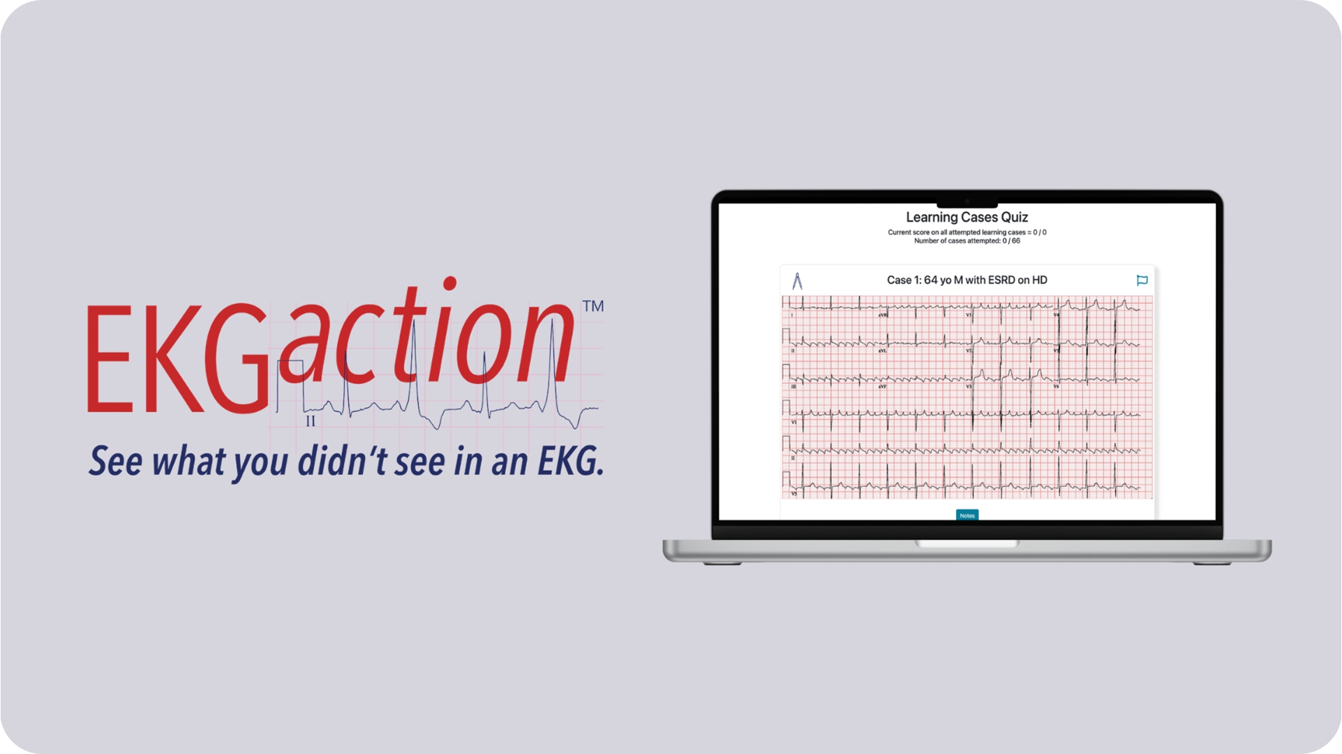 Website Image - Learner Events Page - EKG Mastery Foundations with EKGaction-Learn it well