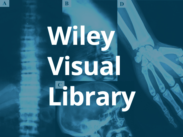 The Wiley Visual Library text logo over-laid on a bluish x-ray collage of spine, ribs, wrist, and cranium